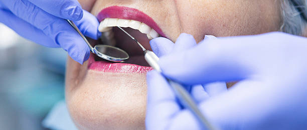 Best Emergency Tooth Extraction in Cole Camp, MO